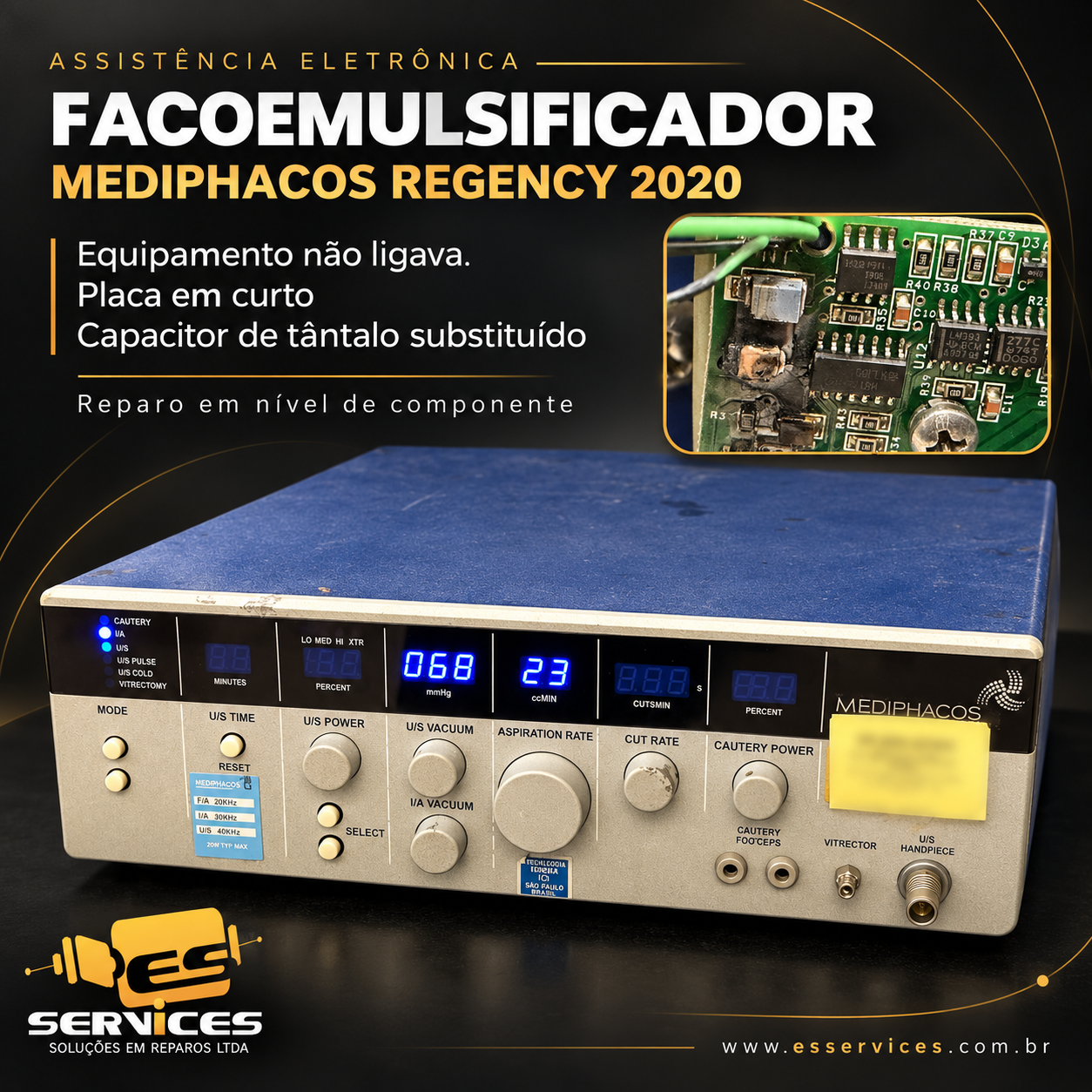 Faco Medphacos Regency 2020 reparado após curto-circuito provocado por capacitor de tântalo.